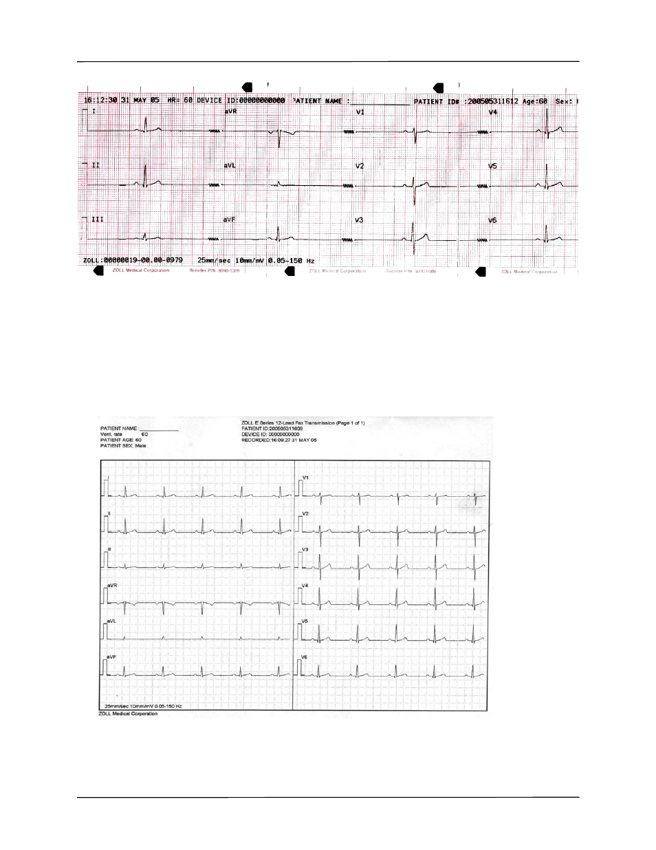 ZOLL E Series Monitor Defibrillator Rev B User Manual | Page 13 / 30