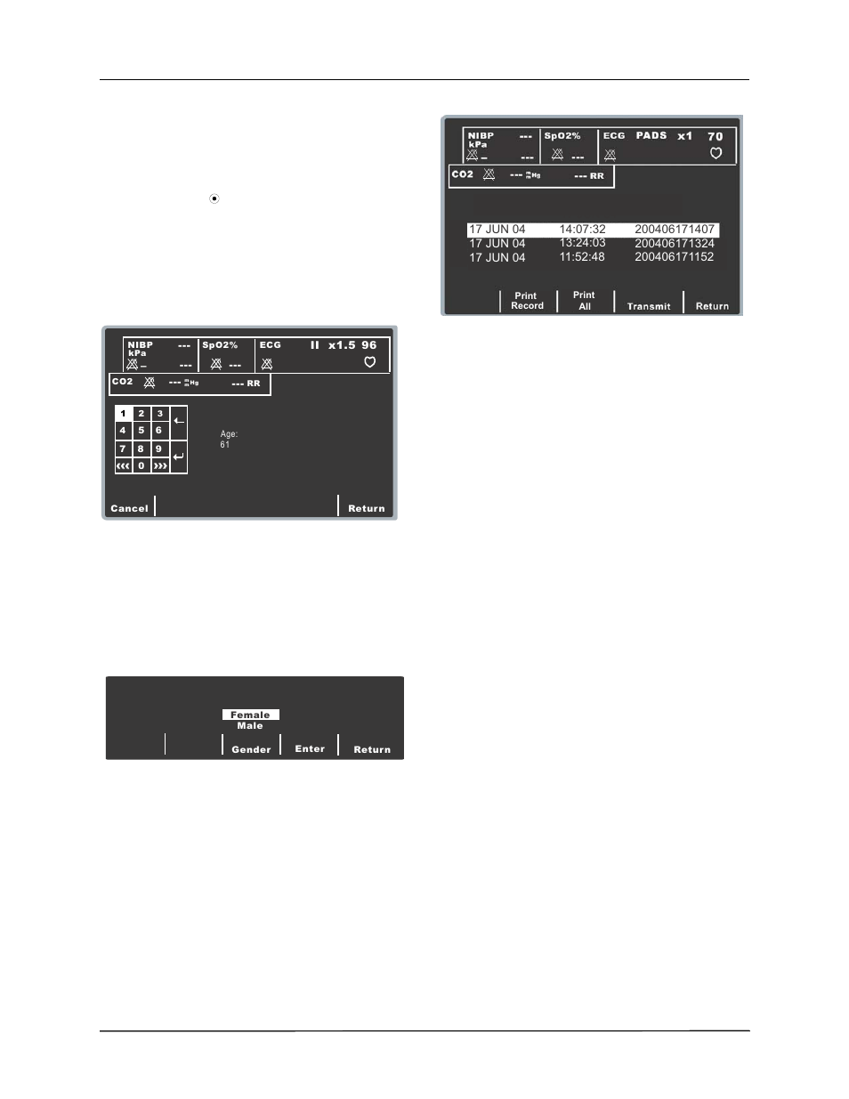 Lead reports | ZOLL E Series Monitor Defibrillator Rev B User Manual | Page 9 / 30