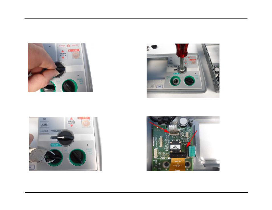 ZOLL E Series Monitor Defibrillator Rev D User Manual | Page 117 / 280