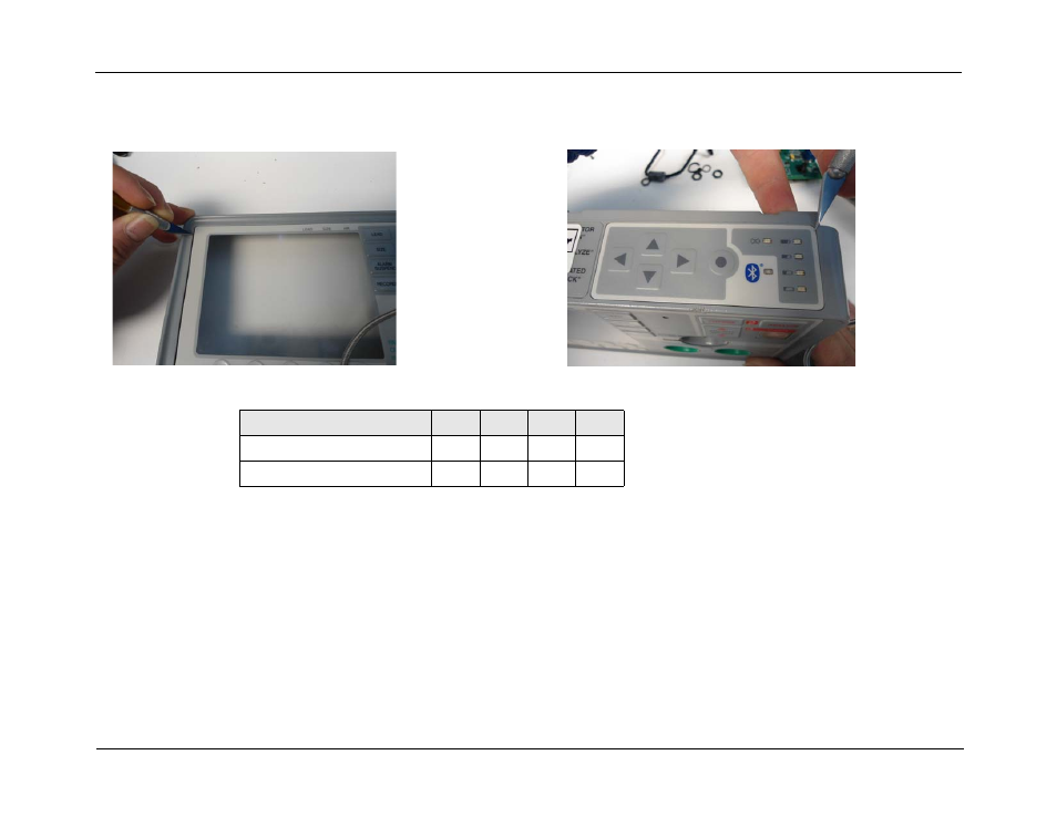 ZOLL E Series Monitor Defibrillator Rev D User Manual | Page 119 / 280