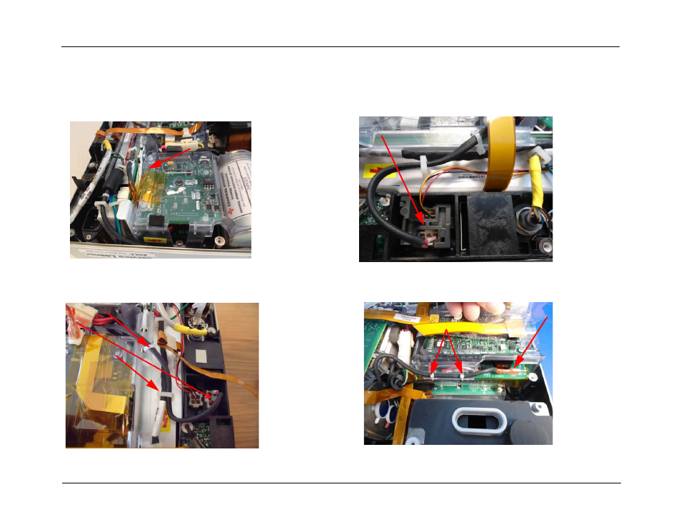 Bridge board removal, Bridge board removal -20 | ZOLL E Series Monitor Defibrillator Rev D User Manual | Page 130 / 280