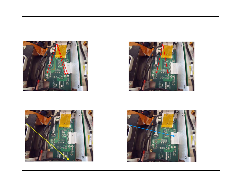 Battery interconnect board removal, Battery interconnect board removal -24 | ZOLL E Series Monitor Defibrillator Rev D User Manual | Page 134 / 280