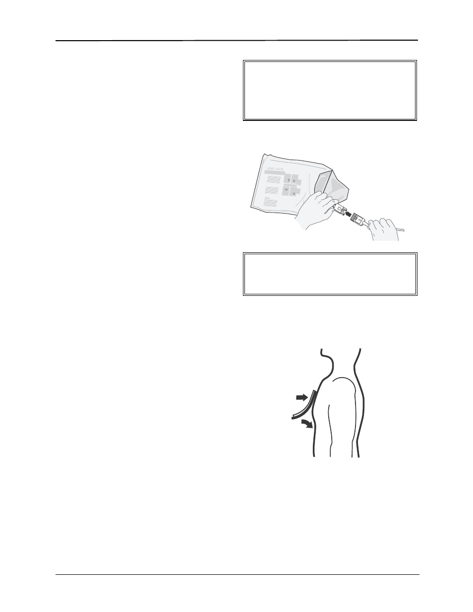 Paddle and electrode options, Mfe pad application/connection, Caution | Warning | ZOLL E Series Monitor Defibrillator Rev D User Manual | Page 165 / 280