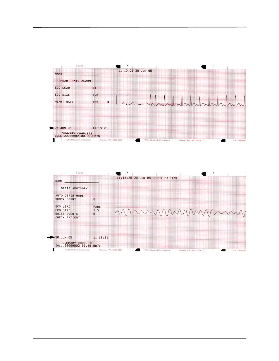 ZOLL E Series Monitor Defibrillator Rev D User Manual | Page 179 / 280