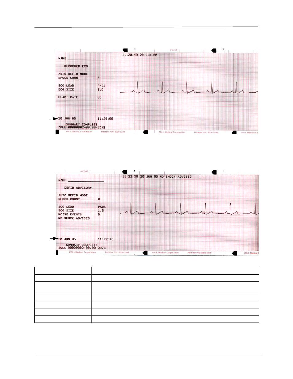 ZOLL E Series Monitor Defibrillator Rev D User Manual | Page 180 / 280