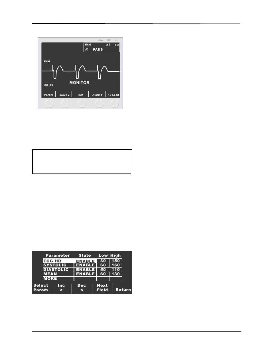 Alarms, Warning, Ecg monitoring | ZOLL E Series Monitor Defibrillator Rev D User Manual | Page 221 / 280