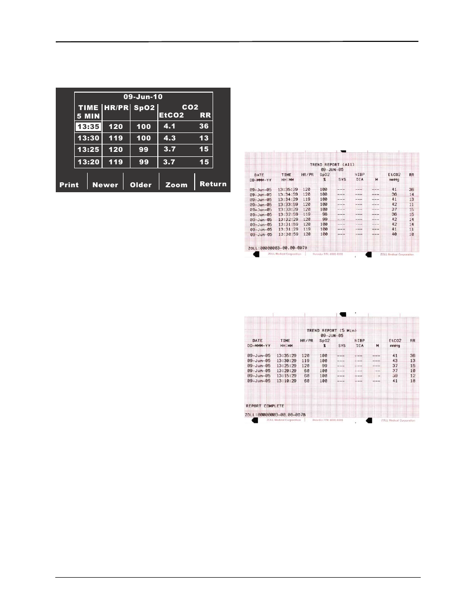 ZOLL E Series Monitor Defibrillator Rev D User Manual | Page 224 / 280