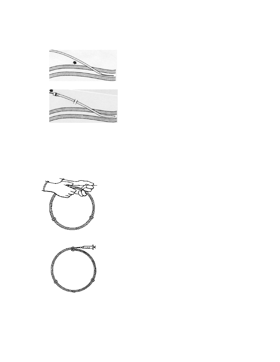 Dispenser, Cool line, Catheter instructions for use | ZOLL IVTM Catheter Cool Line User Manual | Page 6 / 11