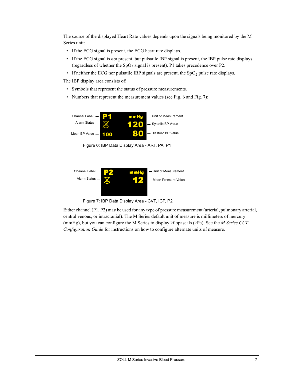 ZOLL M Series CCT Defibrillator Rev D User Manual | Page 13 / 26