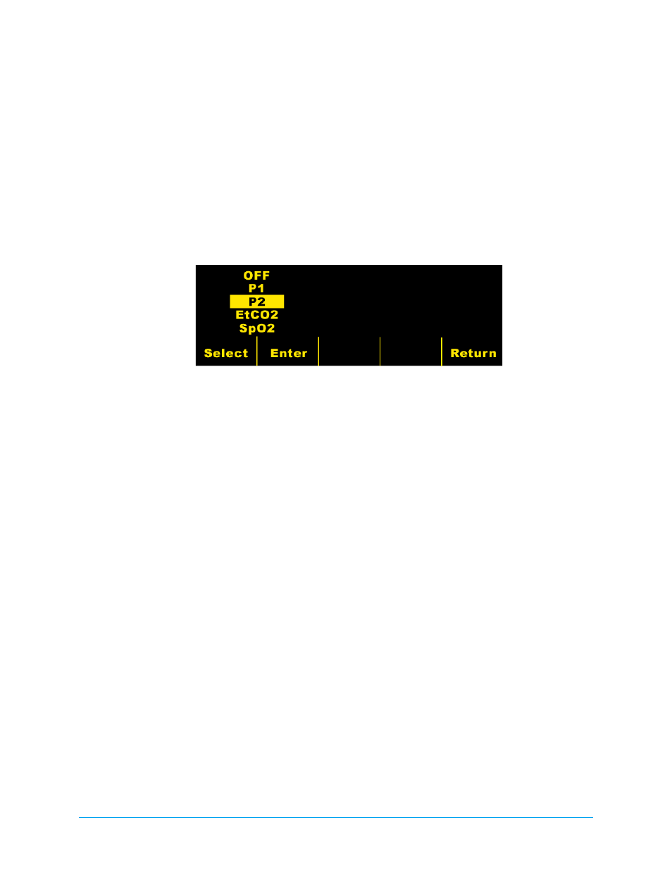 Changing the display traces (cont.) | ZOLL M Series CCT Defibrillator Rev E User Manual | Page 10 / 20