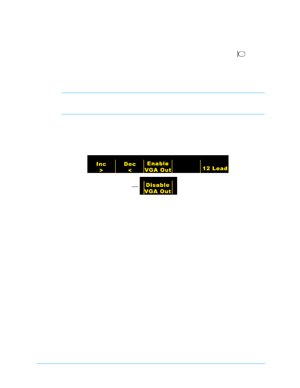Connecting to an external vga display (monitor) | ZOLL M Series CCT Defibrillator Rev E User Manual | Page 11 / 20