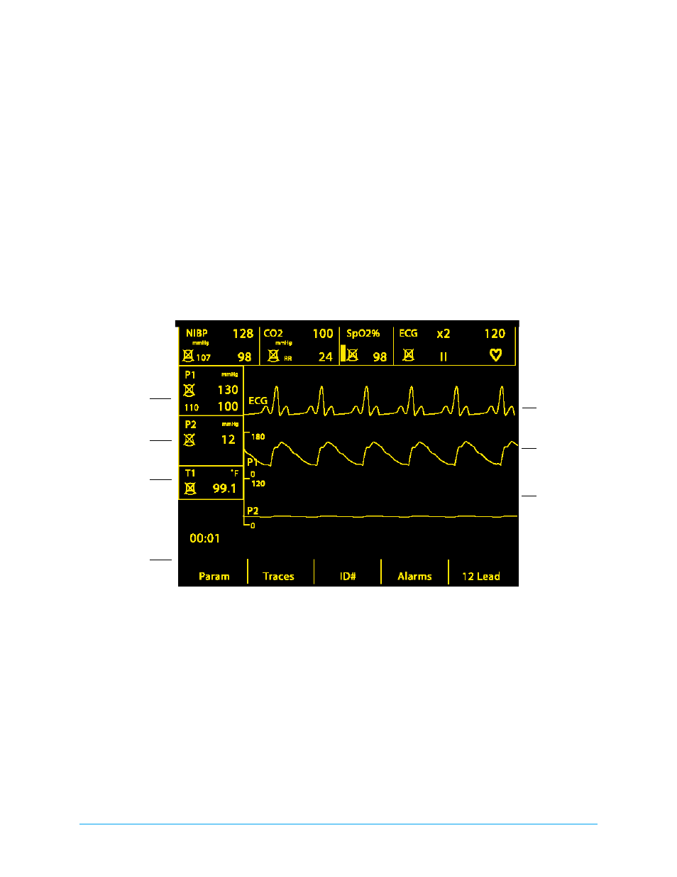 Reading the m series cct display | ZOLL M Series CCT Defibrillator Rev E User Manual | Page 8 / 20