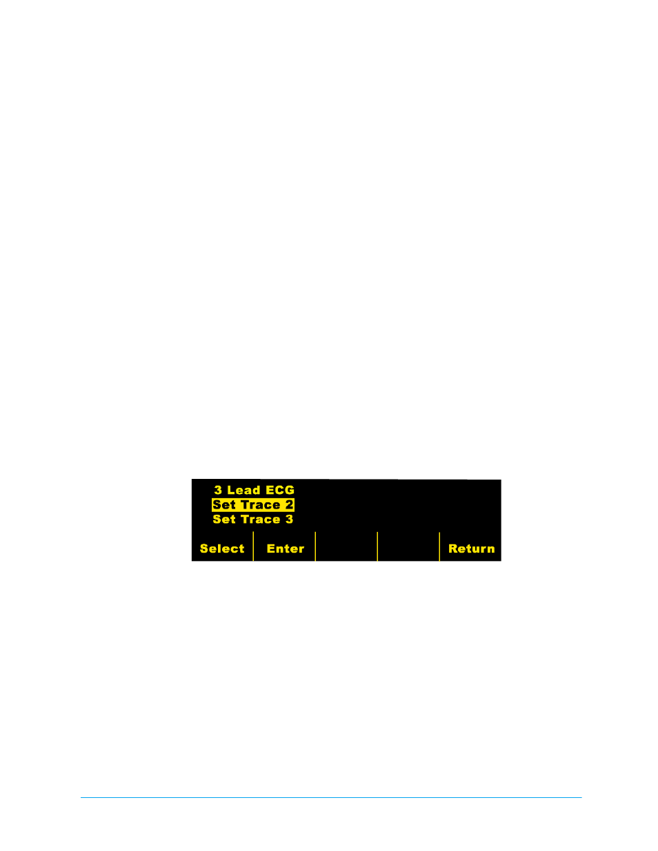 Using the m series cct options, Changing the display traces | ZOLL M Series CCT Defibrillator Rev E User Manual | Page 9 / 20