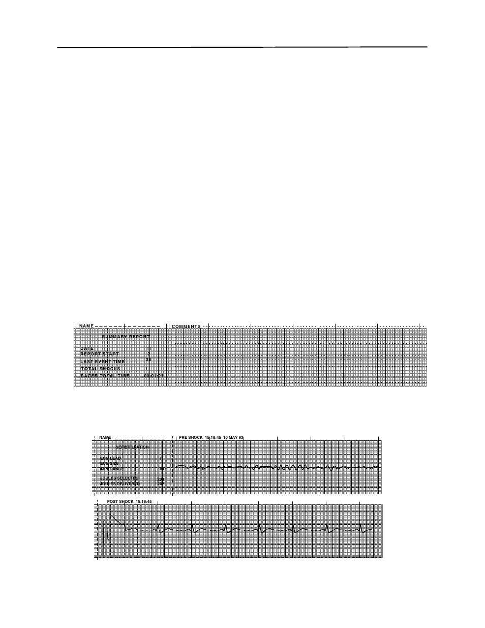 Summary report | ZOLL M Series Defibrillator Rev YH User Manual | Page 26 / 96