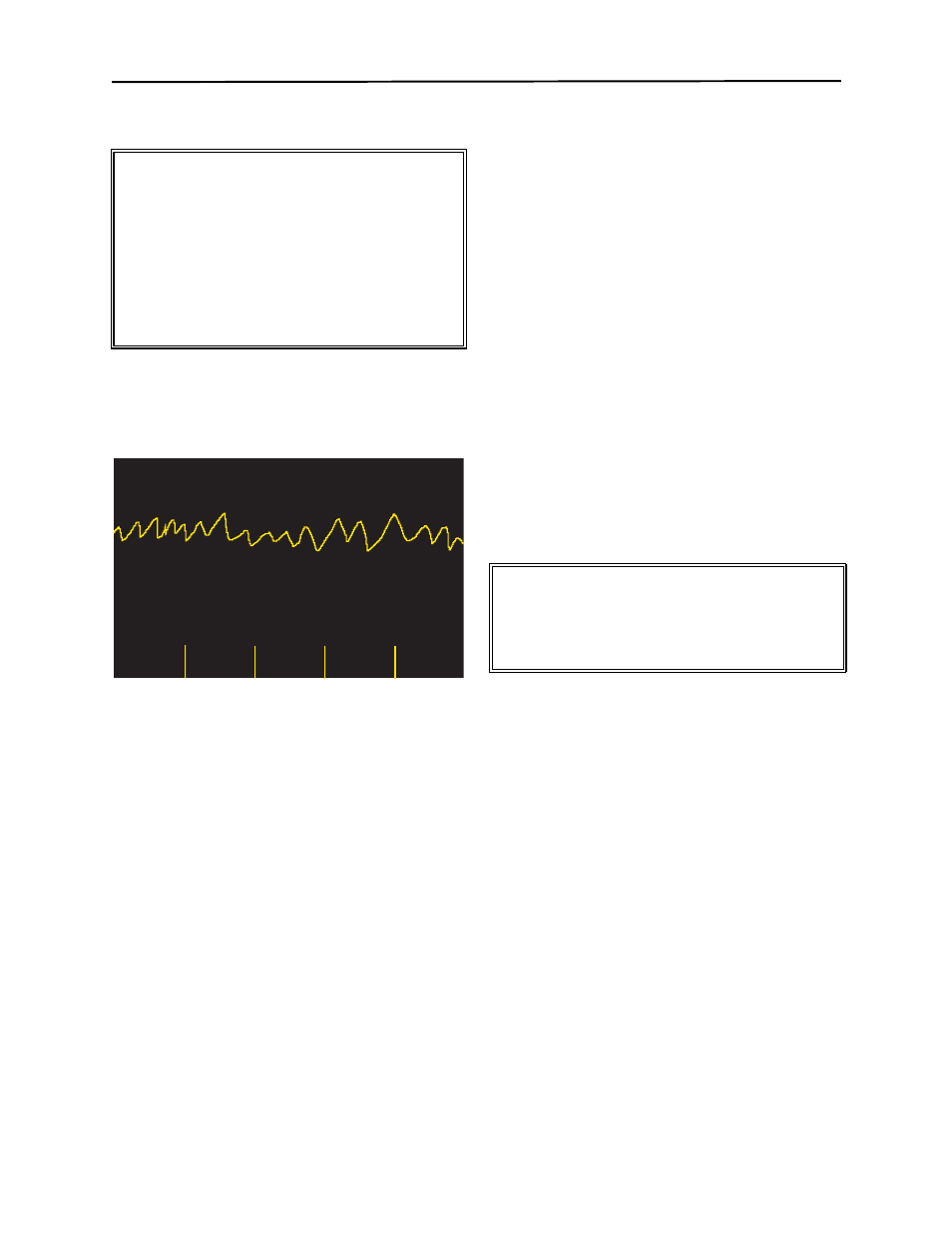 Defib 200j ready, Press shock | ZOLL M Series Defibrillator Rev YH User Manual | Page 39 / 96