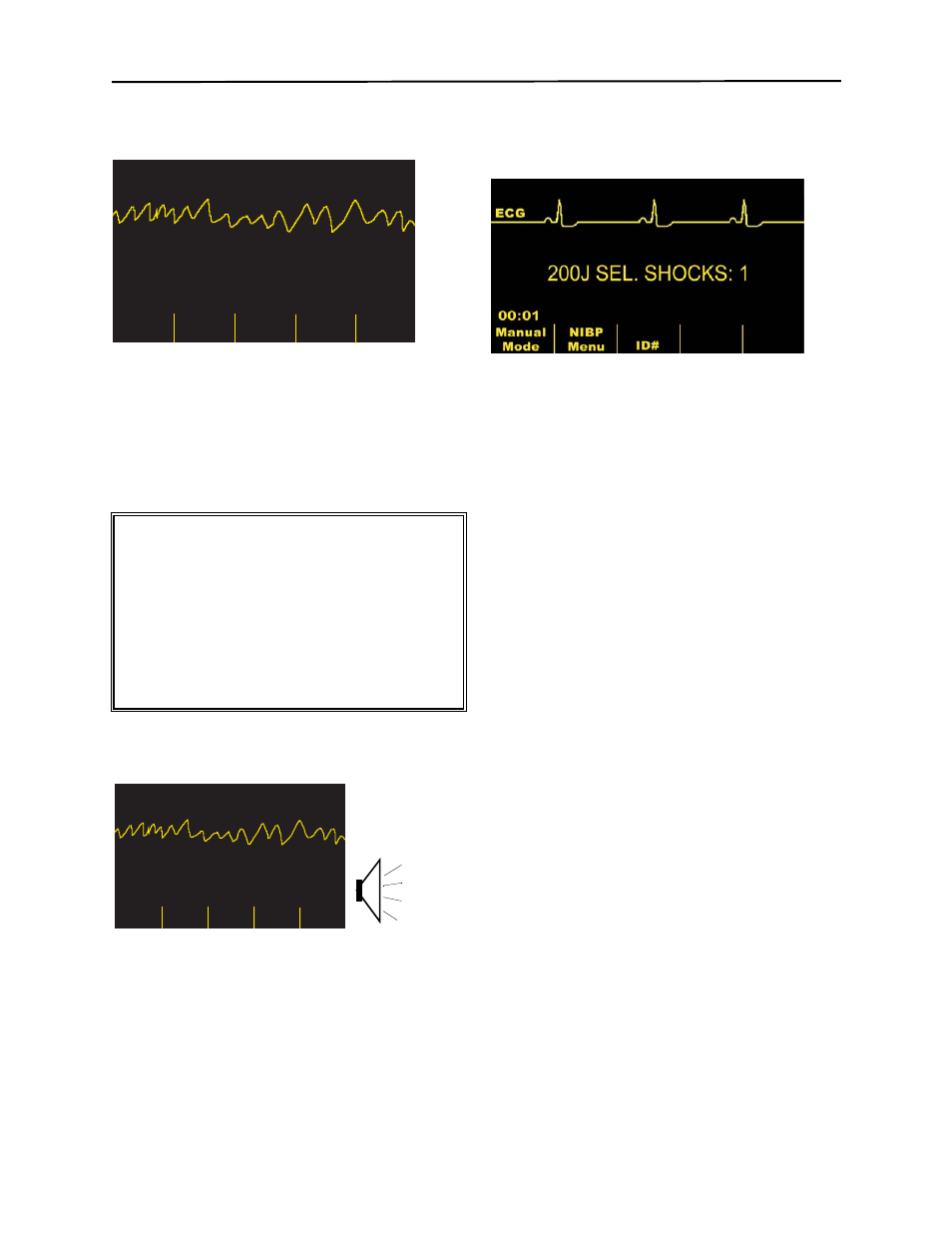 Charging 76j, Shock advised, Warning | ZOLL M Series Defibrillator Rev YH User Manual | Page 43 / 96