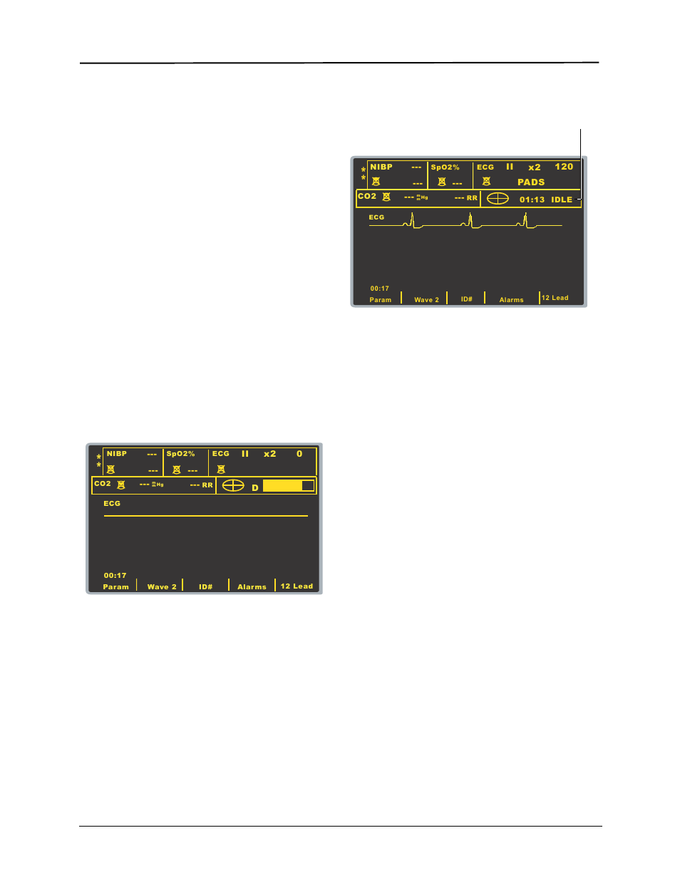 Cpr compressions indicator, Cpr idle time display, Cpr metronome | ZOLL M Series Defibrillator Rev YH User Manual | Page 52 / 96