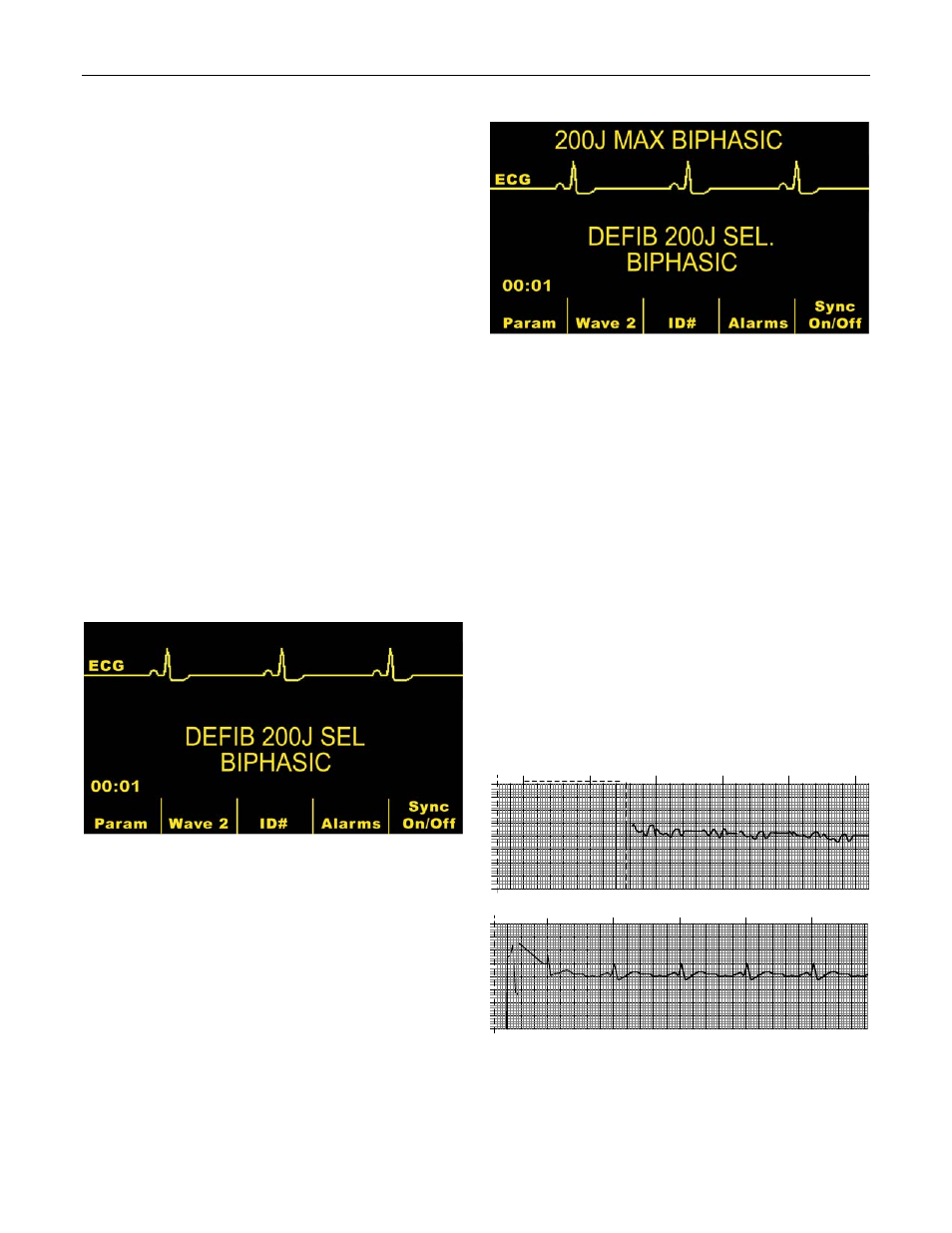 Defibrillator function, Energy selection and displays, Charge time | Recorder printer annotations | ZOLL M Series Defibrillator Rev E BiPhasic User Manual | Page 2 / 7