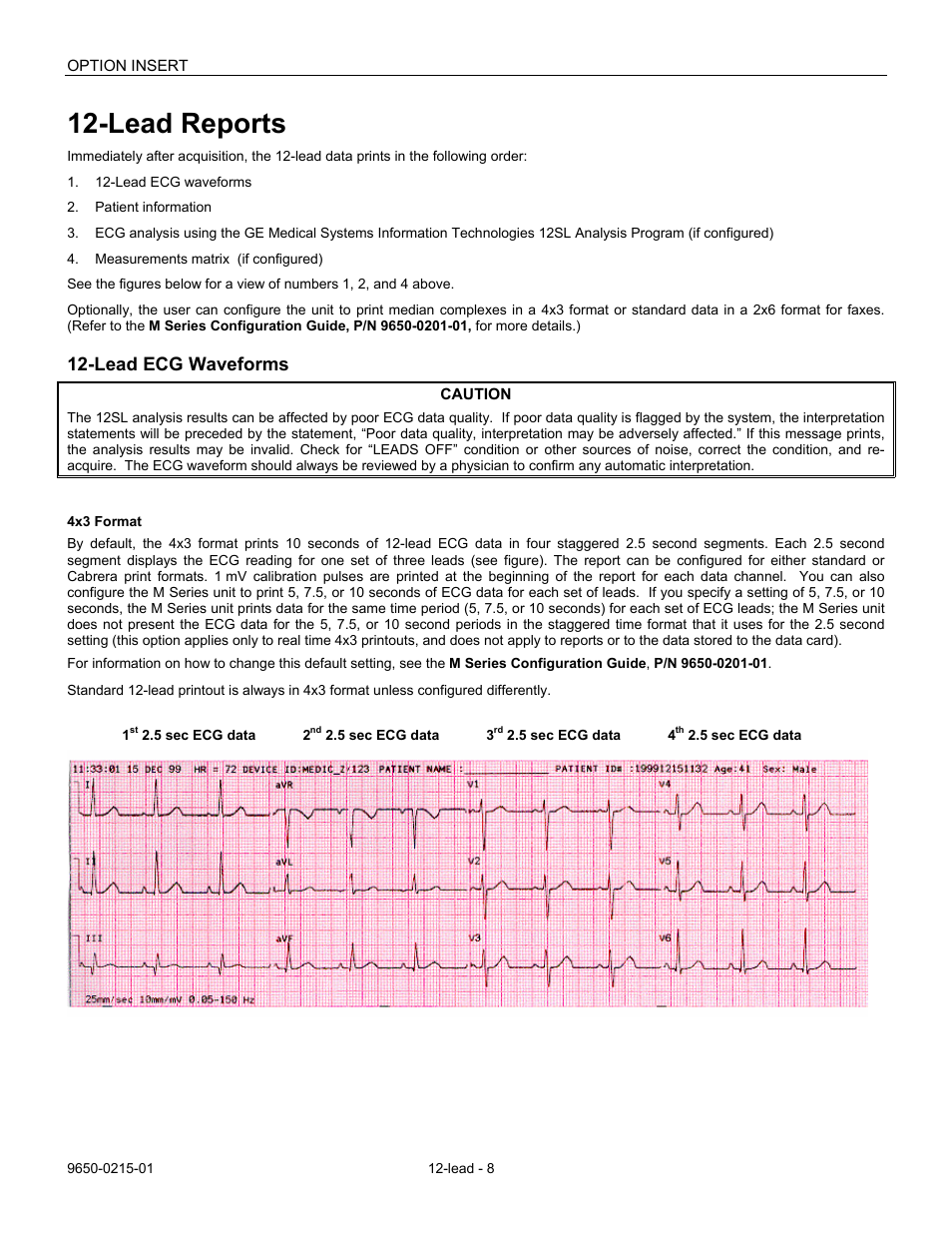 Lead reports, Lead ecg waveforms | ZOLL M Series Defibrillator Rev H User Manual | Page 10 / 23