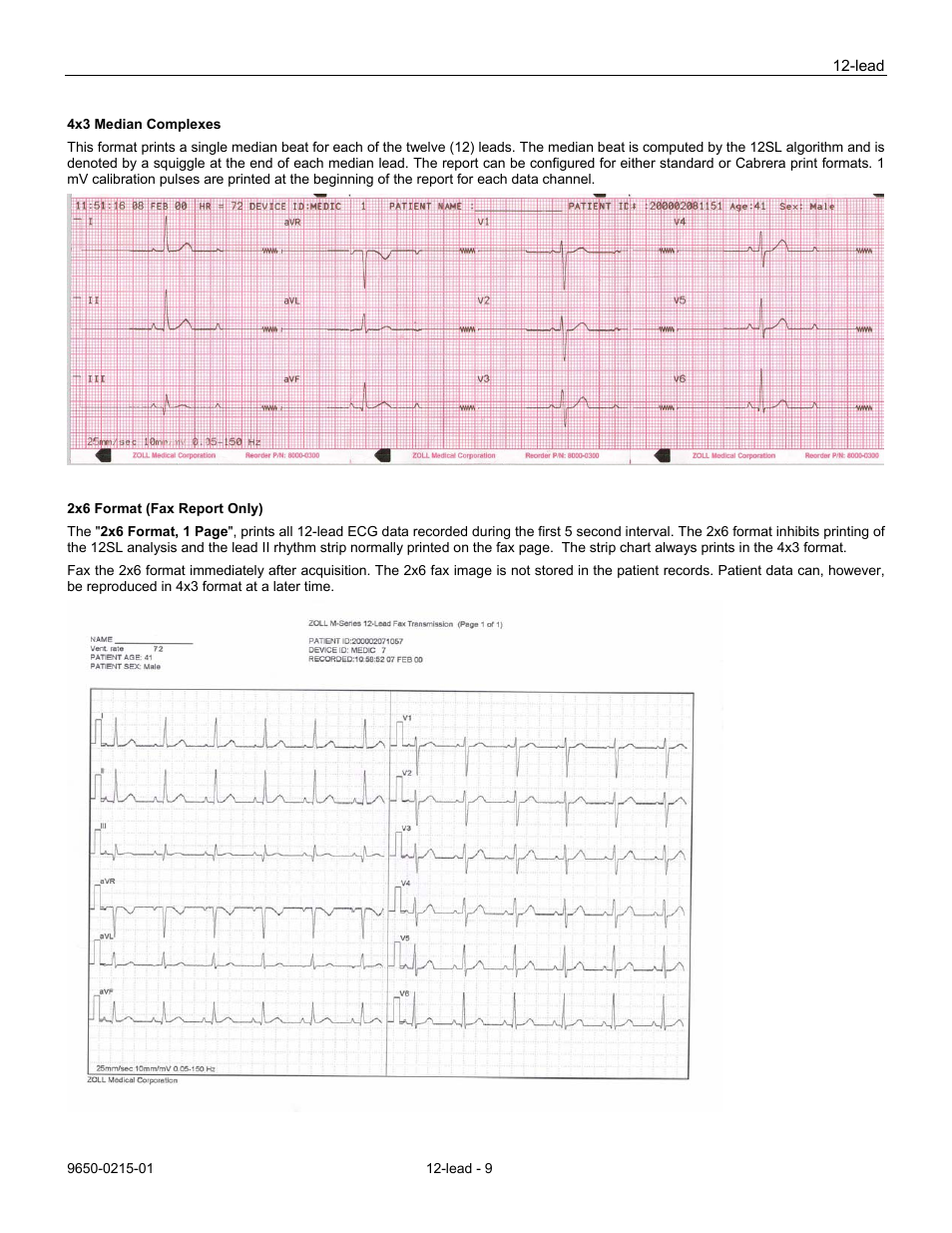 ZOLL M Series Defibrillator Rev H User Manual | Page 11 / 23