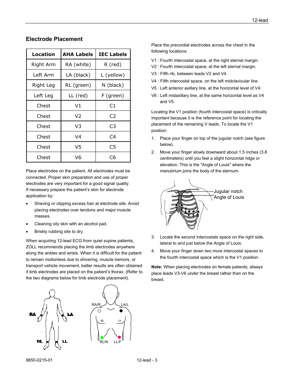 Electrode placement | ZOLL M Series Defibrillator Rev H User Manual | Page 5 / 23