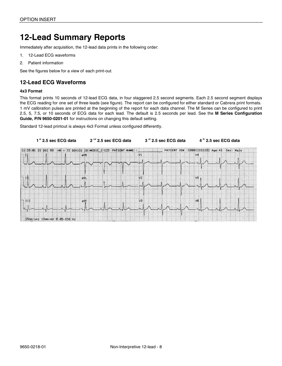 Lead summary reports, Lead ecg waveforms | ZOLL M Series Defibrillator Rev B Non-Int 12 Lead User Manual | Page 10 / 20