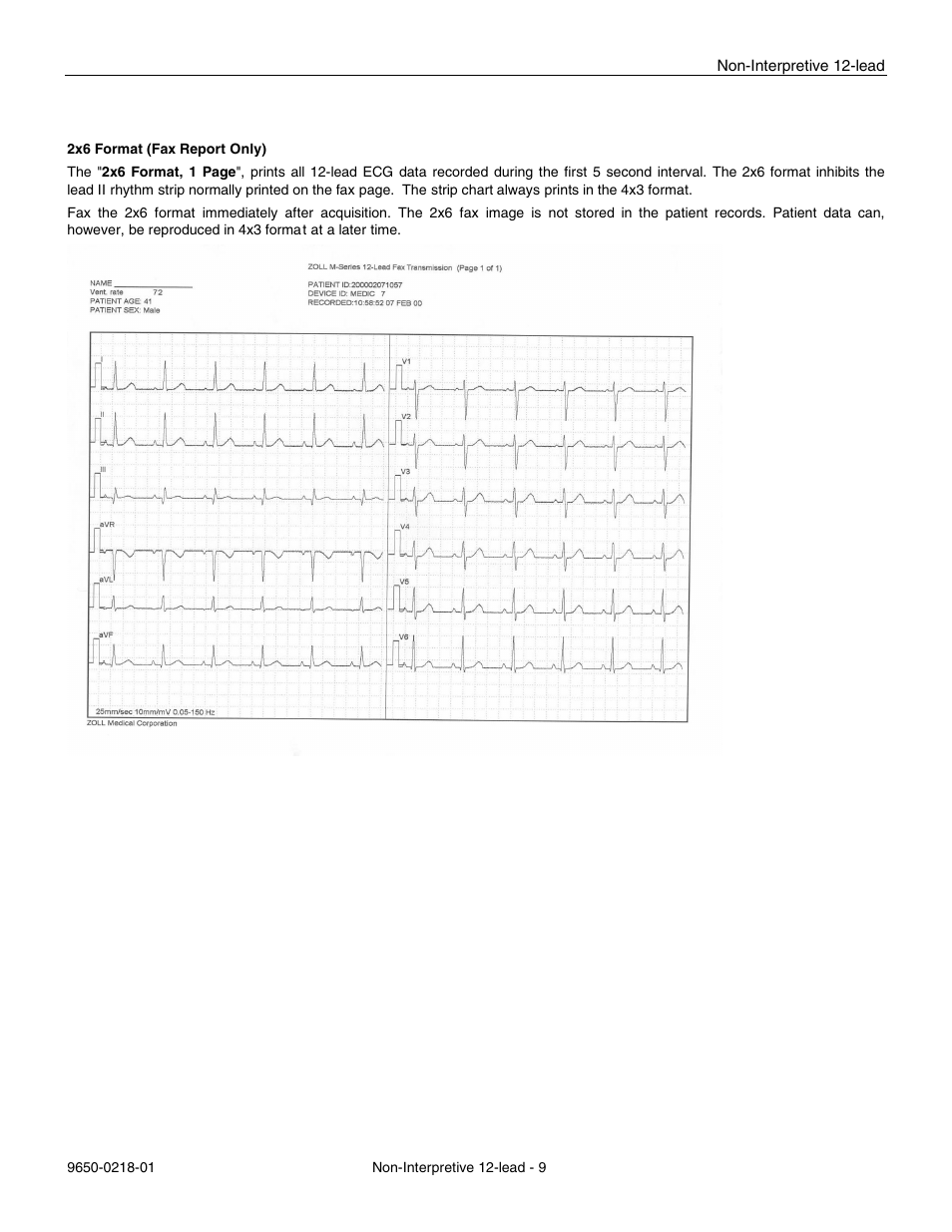 ZOLL M Series Defibrillator Rev B Non-Int 12 Lead User Manual | Page 11 / 20