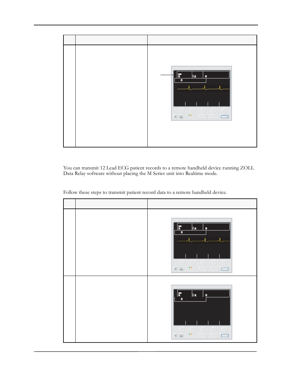 Transmitting 12 lead ecg patient records, Rs-232 e, Luetooth | Nhanced, Ommunication, Monitor, Realtime mode indicator, 12 lead monitor | ZOLL M Series Defibrillator Rev E Bluetooth User Manual | Page 8 / 12