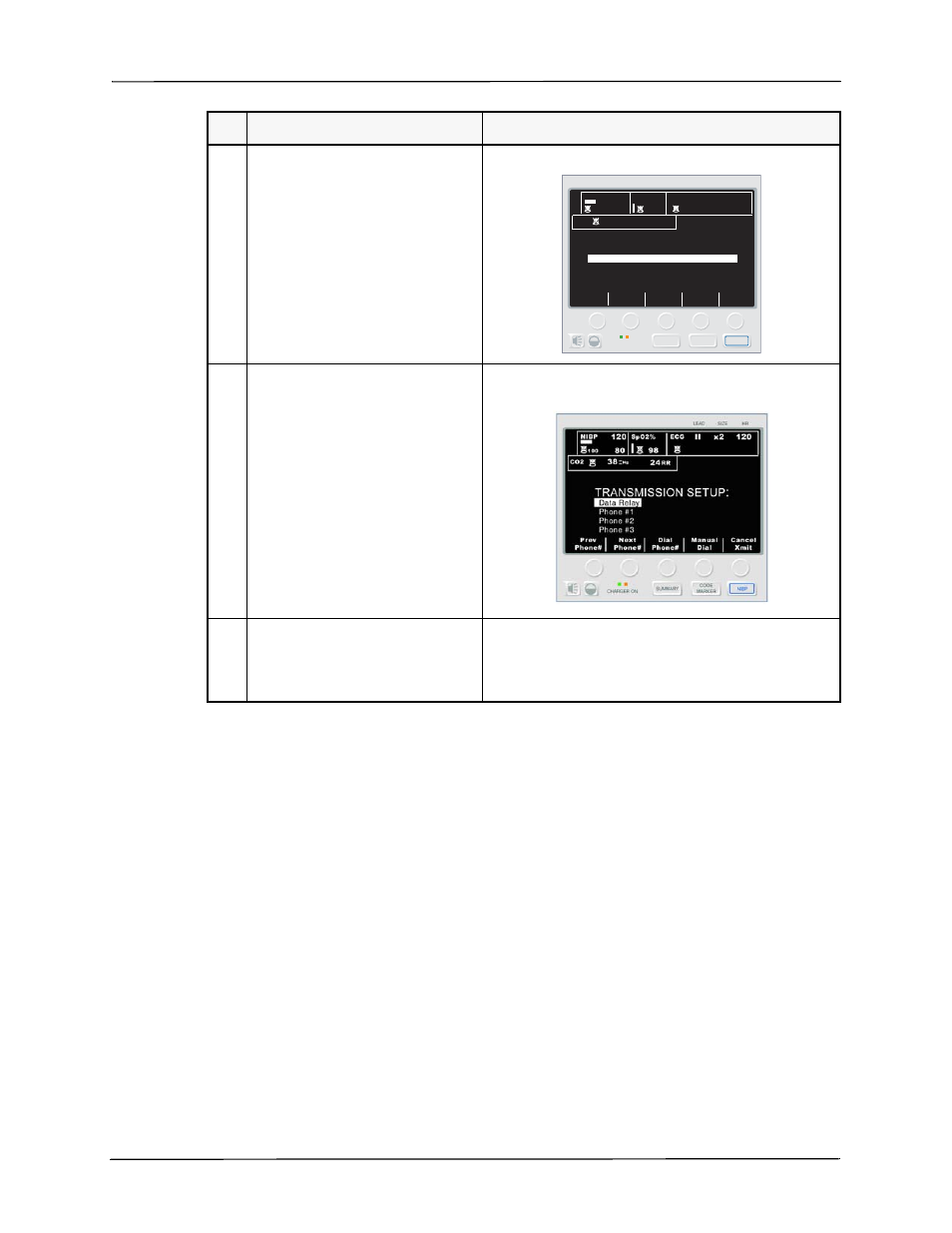 Data transmission | ZOLL M Series Defibrillator Rev E Bluetooth User Manual | Page 9 / 12