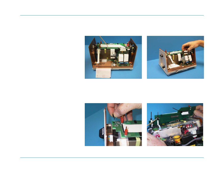 Removing the battery interconn ect board assembly, Removing the battery interconnect board assembly | ZOLL M Series Defibrillator Rev R User Manual | Page 100 / 154