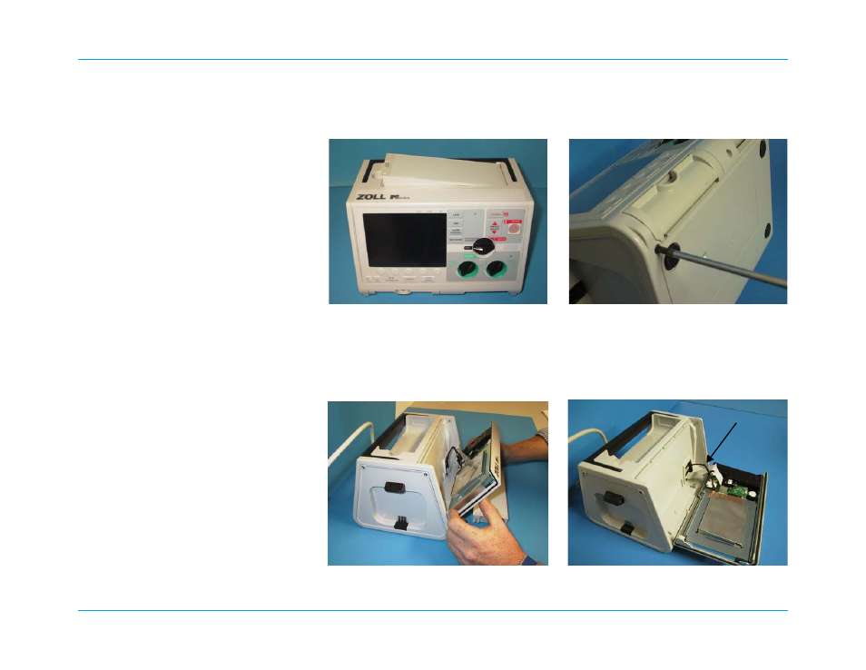 Removing the front panel | ZOLL M Series Defibrillator Rev R User Manual | Page 92 / 154