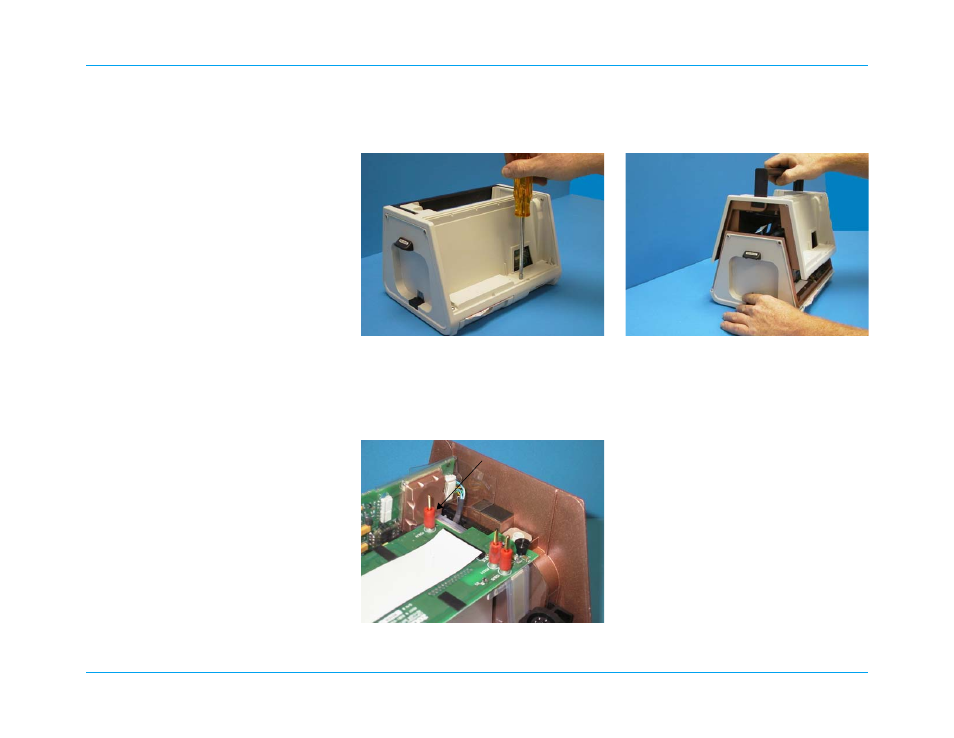 Removing the upper housing assembly | ZOLL M Series Defibrillator Rev R User Manual | Page 96 / 154