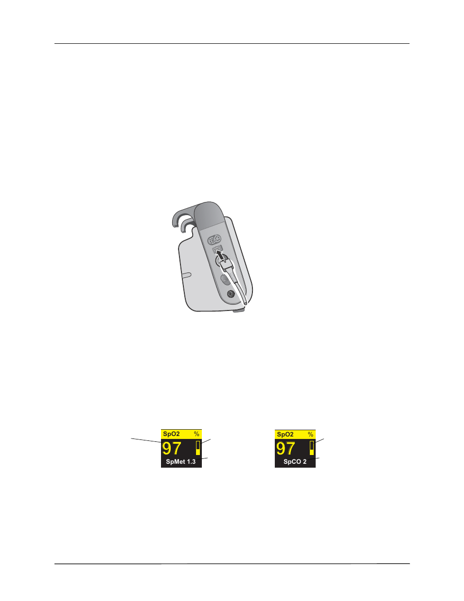 Connecting the spo, Sensor, Displaying spo | Spco, and spmet measurements, Cleaning and reuse of sensors | ZOLL Propaq M Rev B User Manual | Page 122 / 210