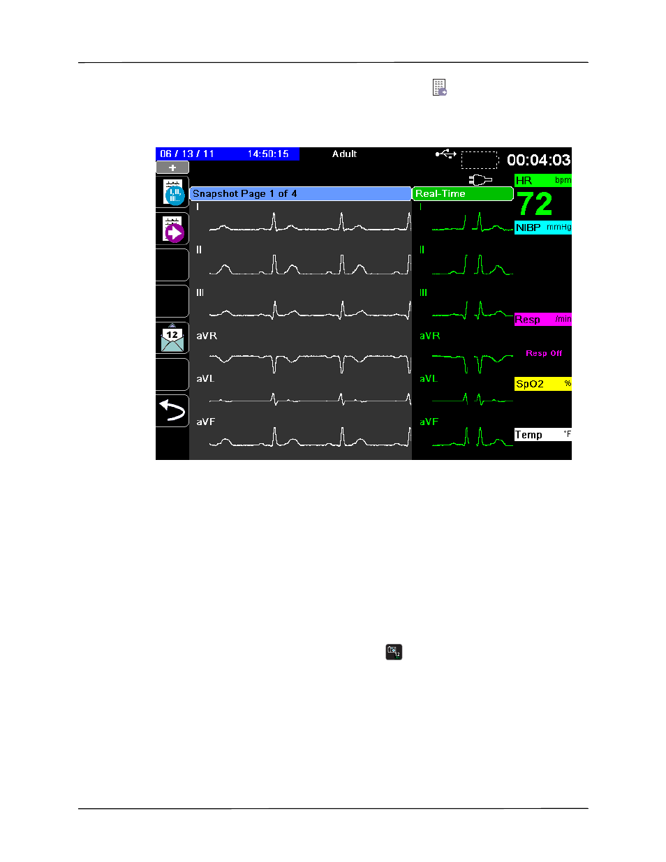 ZOLL Propaq M Rev B User Manual | Page 155 / 210