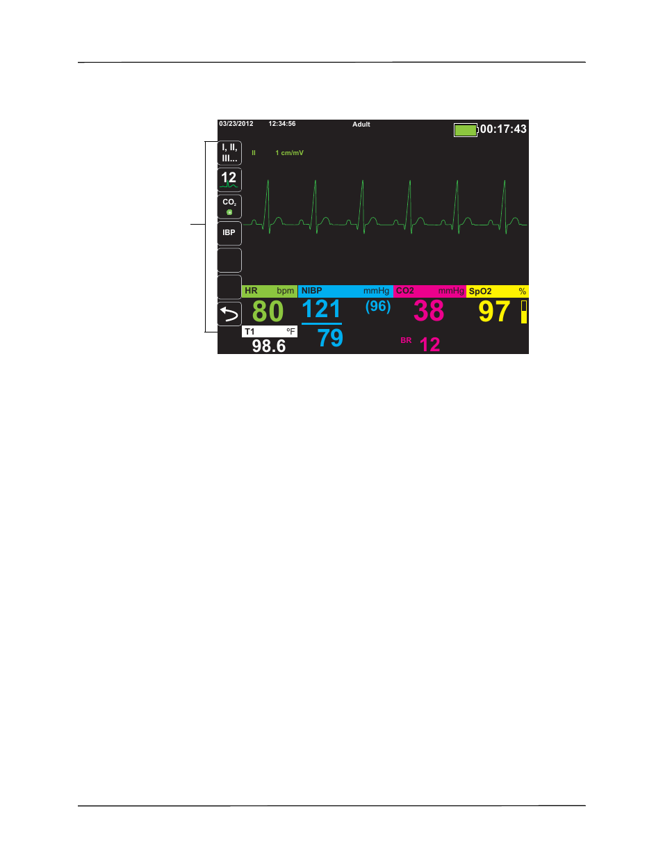 ZOLL Propaq M Rev B User Manual | Page 33 / 210