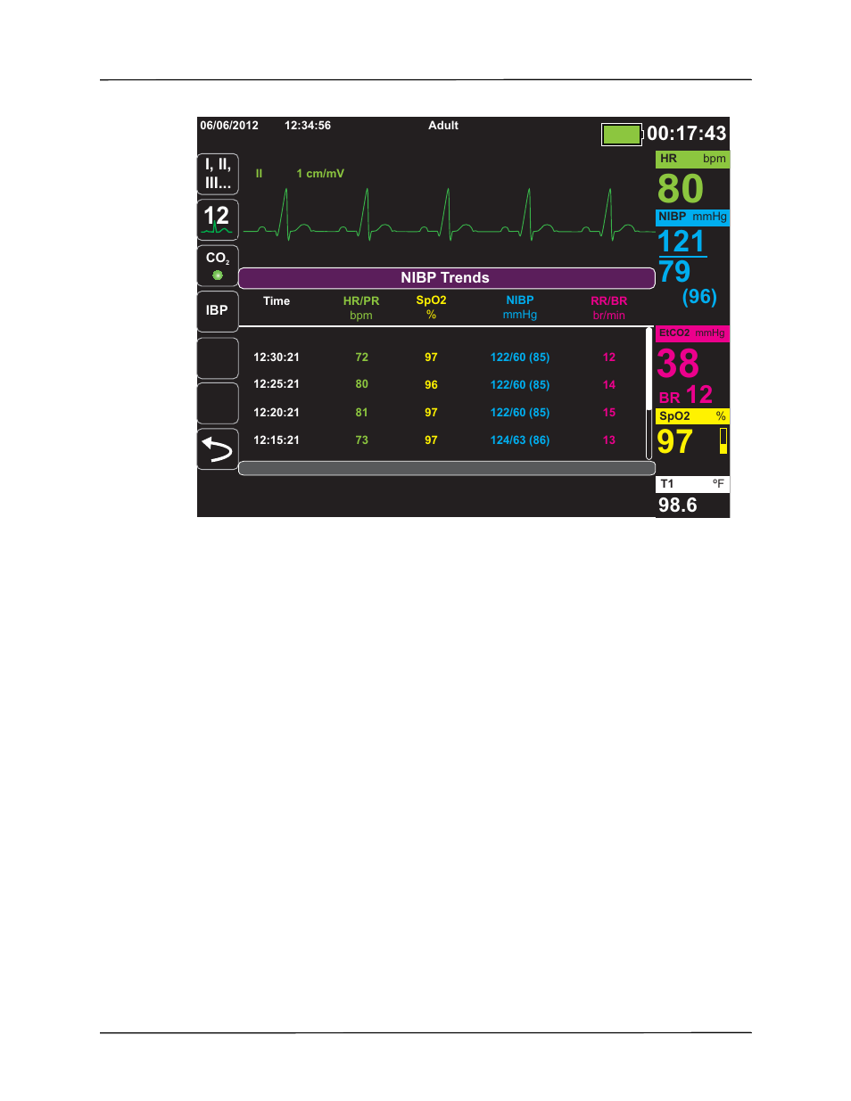 ZOLL Propaq M Rev B User Manual | Page 47 / 210