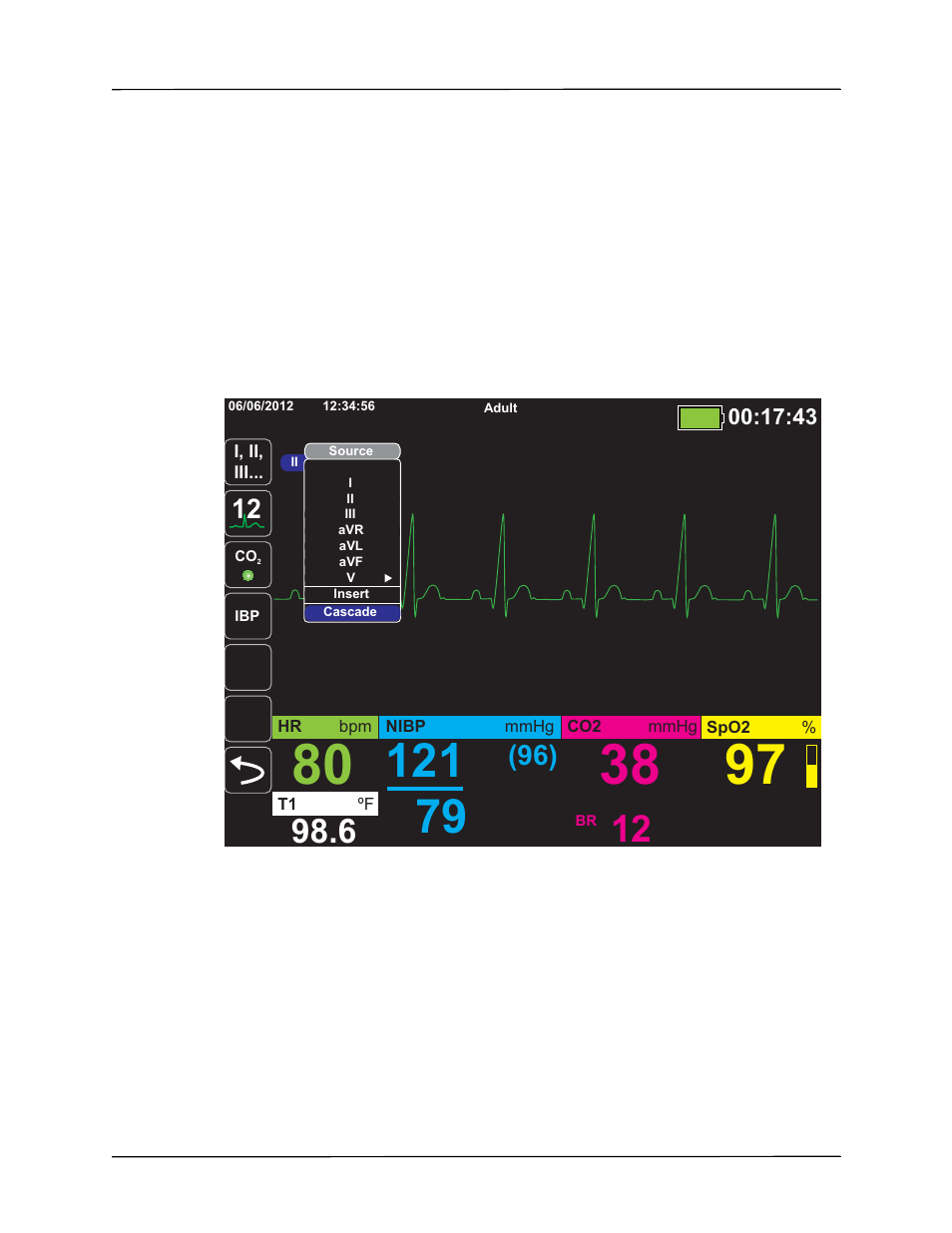 Configuring the waveform display | ZOLL Propaq M Rev B User Manual | Page 49 / 210