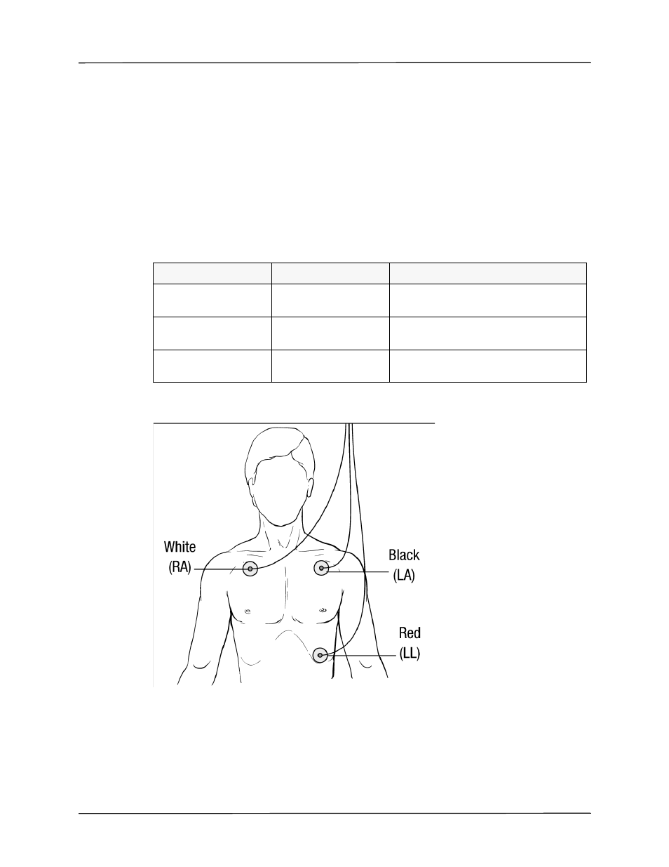 Applying electrodes to the patient | ZOLL Propaq M Rev B User Manual | Page 69 / 210