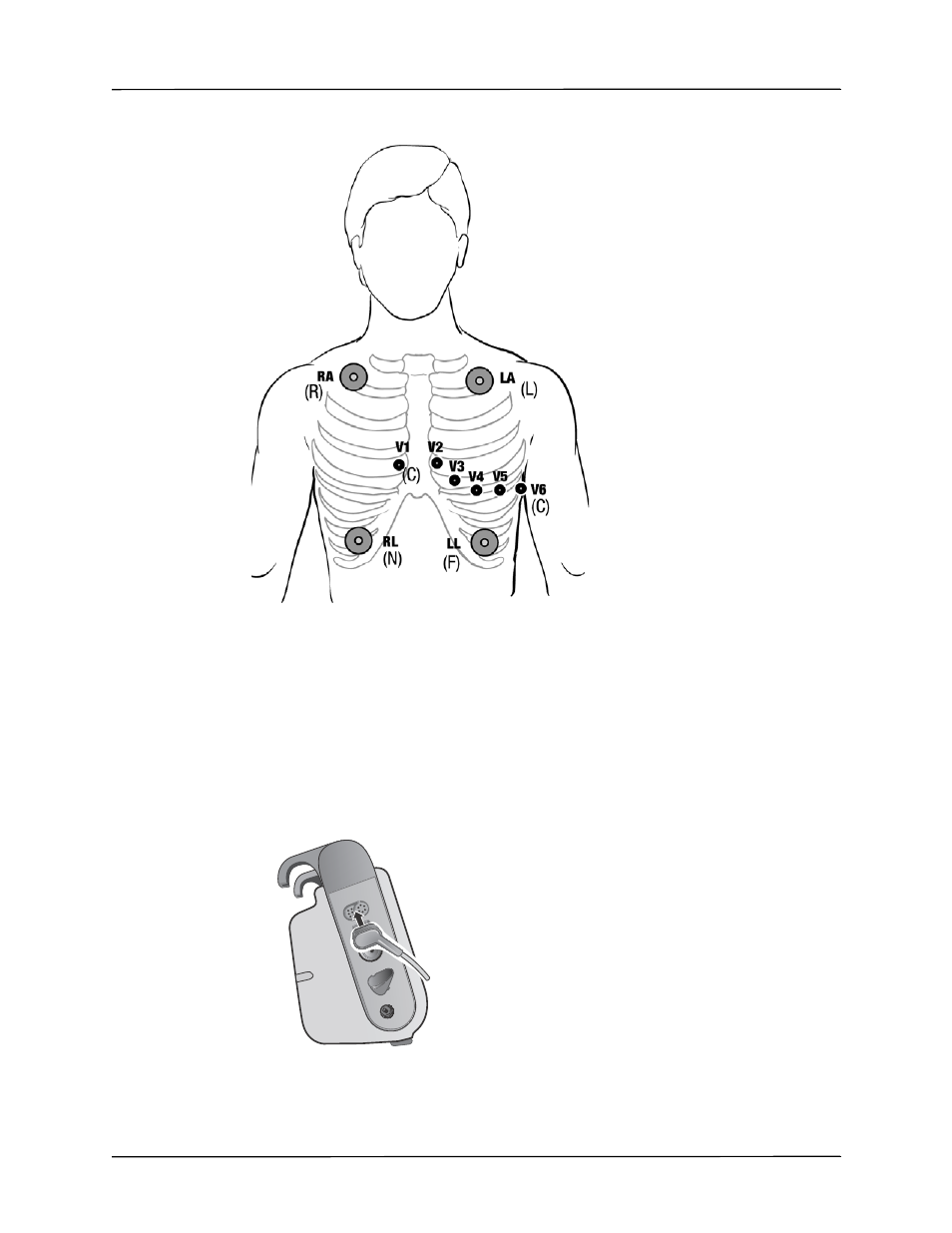 Connecting the ecg cable to the propaq m unit | ZOLL Propaq M Rev B User Manual | Page 71 / 210