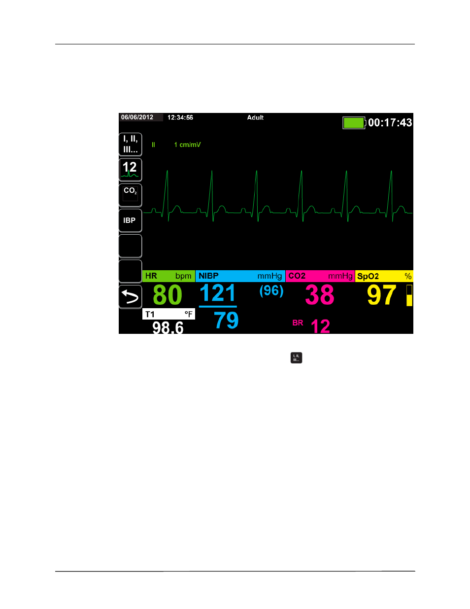 Selecting ecg waveforms for display | ZOLL Propaq M Rev B User Manual | Page 72 / 210