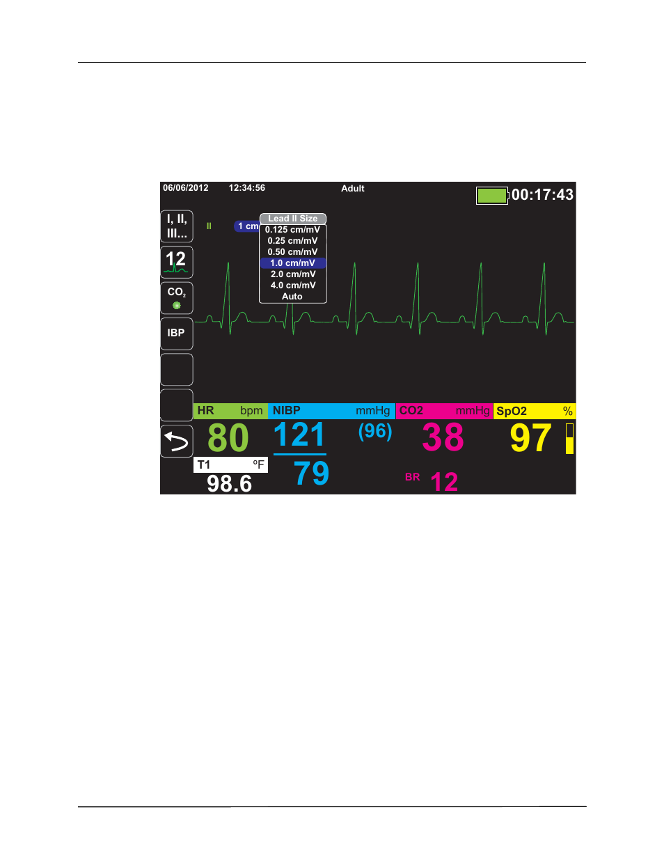 ZOLL Propaq M Rev B User Manual | Page 74 / 210