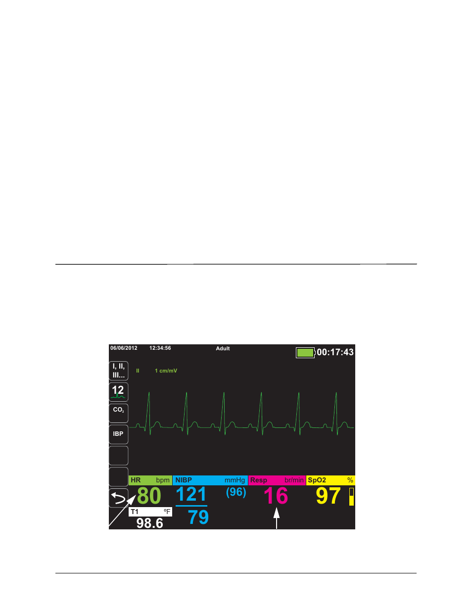 Chapter 7, Monitoring respiration (resp) and heart rate (hr) | ZOLL Propaq M Rev B User Manual | Page 77 / 210
