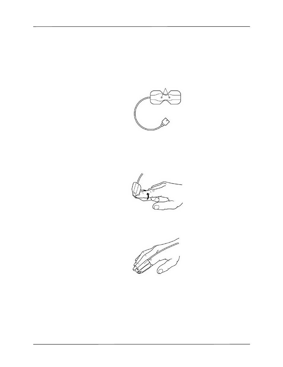 Applying a single-use sensor | ZOLL Propaq M Rev B User Manual | Page 101 / 170