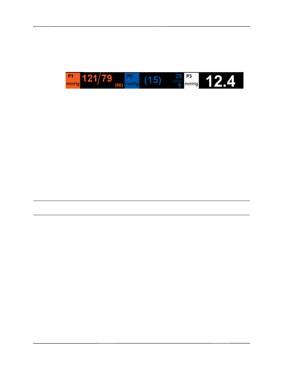 Displaying ibp measurements, Conditions affecting ibp measurements | ZOLL Propaq M Rev B User Manual | Page 123 / 170