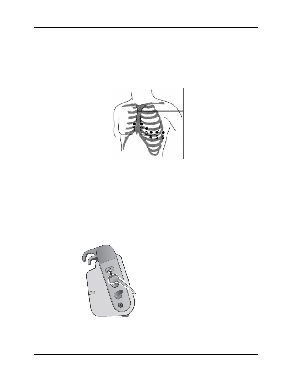 Connecting the 12-lead cable | ZOLL Propaq M Rev B User Manual | Page 141 / 170