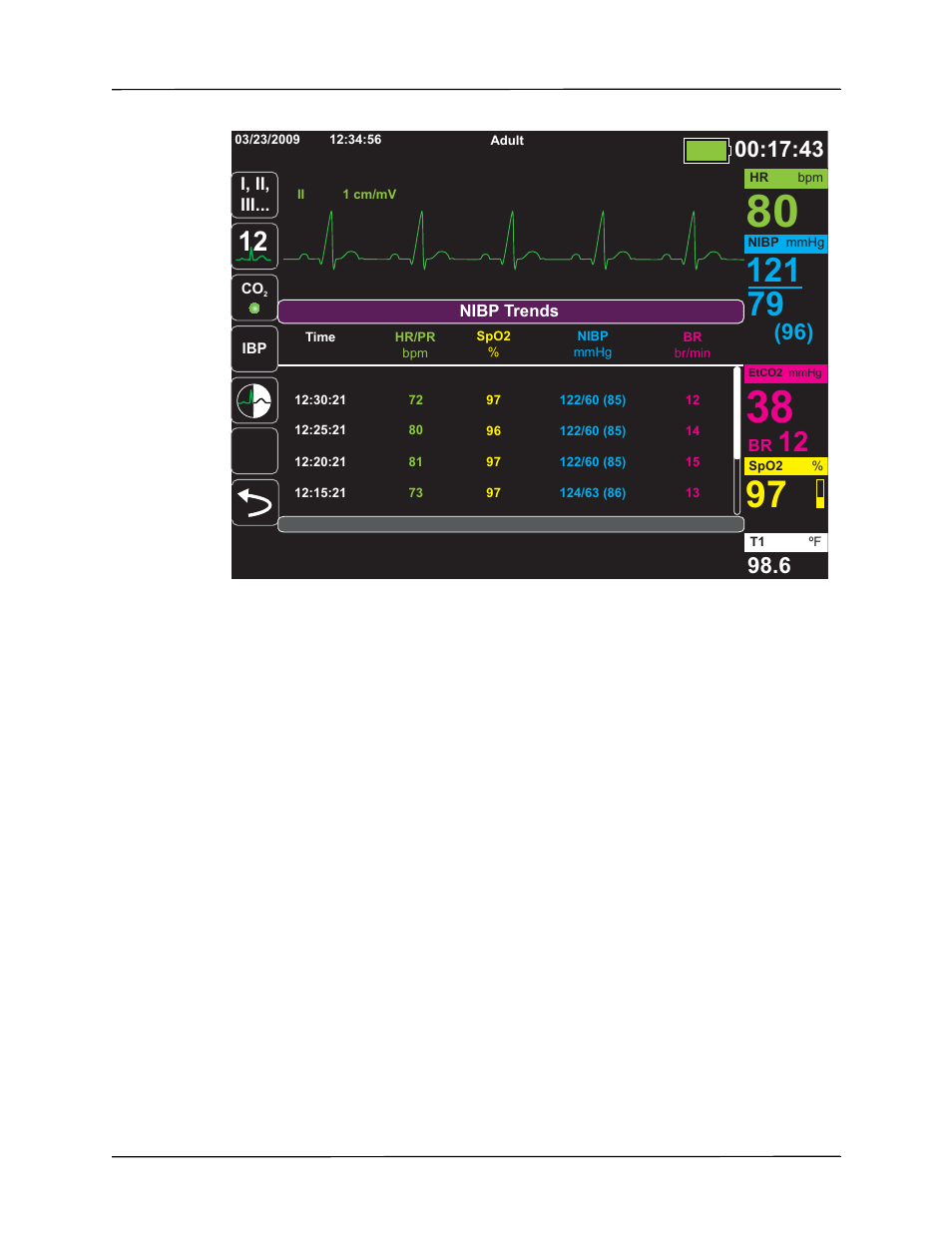 ZOLL Propaq M Rev B User Manual | Page 45 / 170