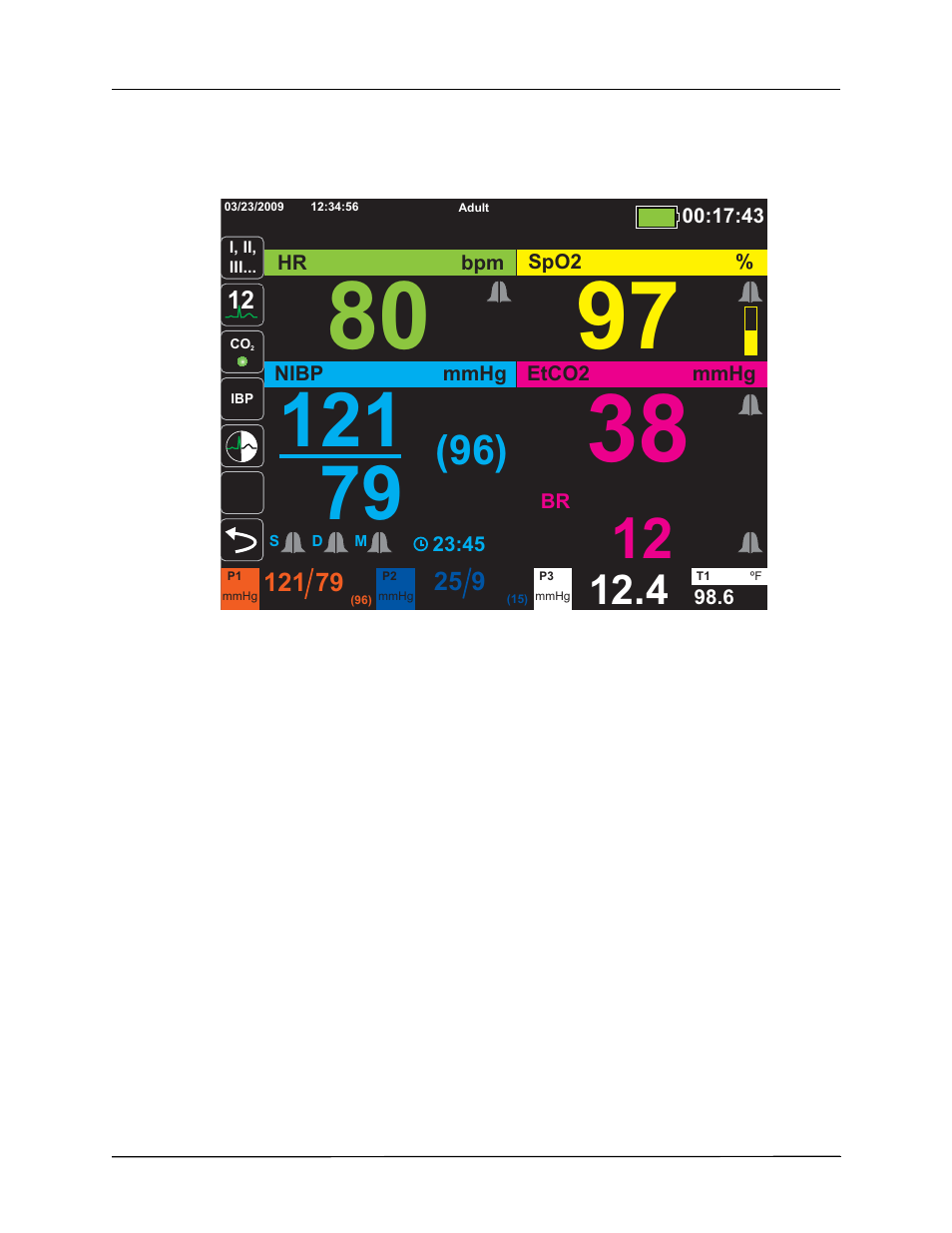 ZOLL Propaq M Rev B User Manual | Page 46 / 170