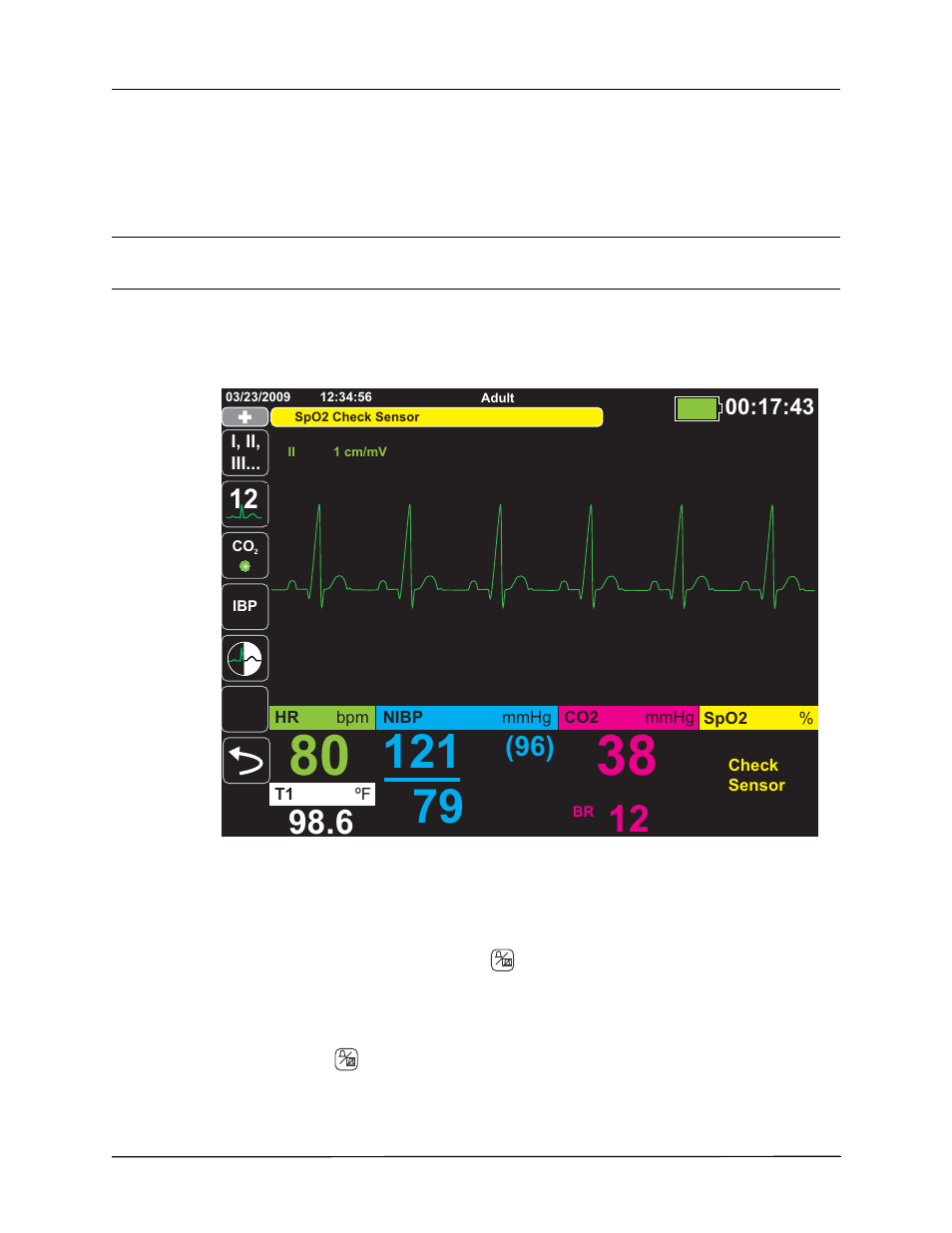 Equipment alert display, Responding to active alarms -- silencing the alarm | ZOLL Propaq M Rev B User Manual | Page 58 / 170