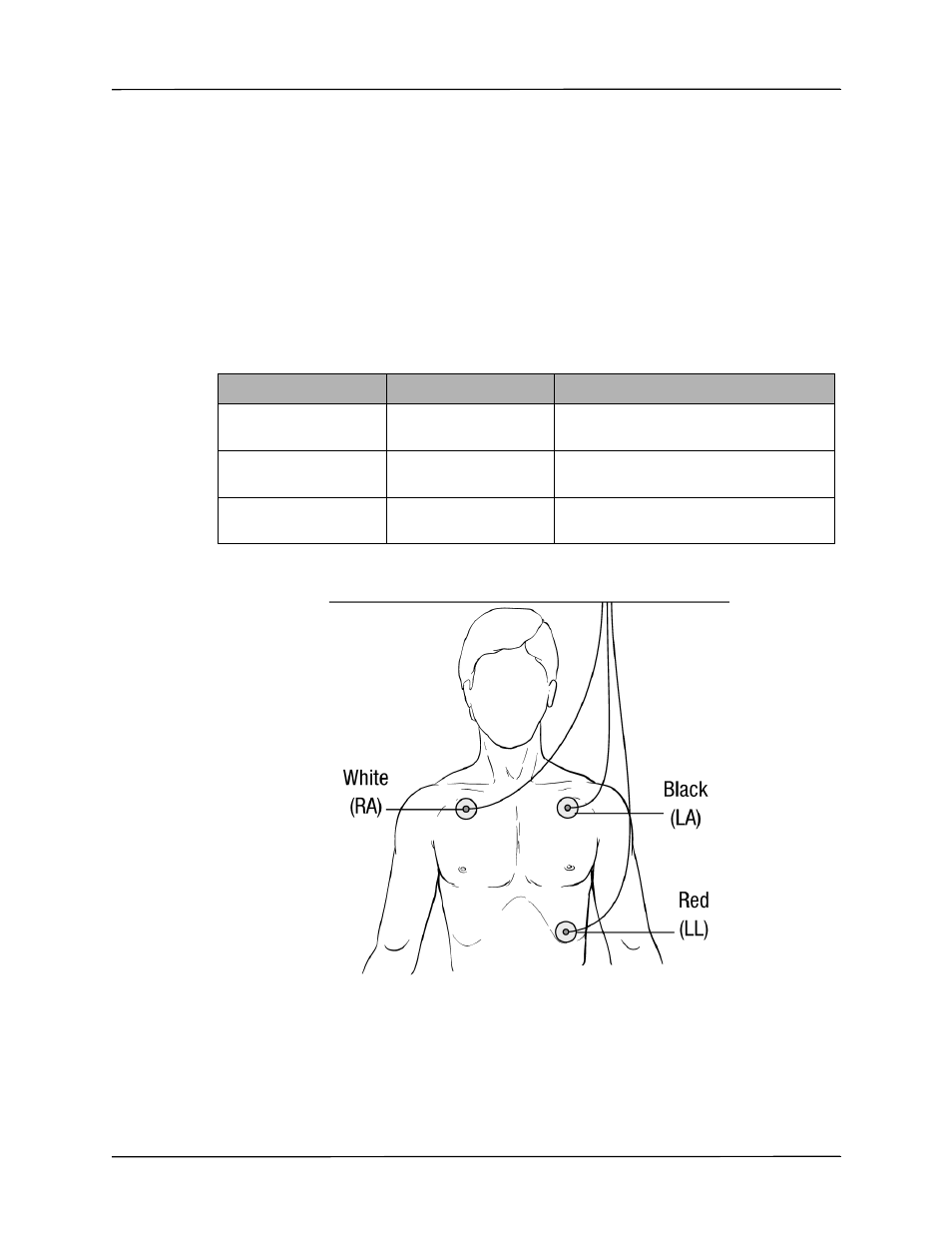 Applying electrodes to the patient | ZOLL Propaq M Rev B User Manual | Page 67 / 170