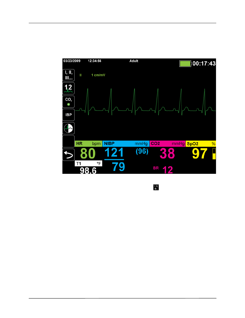 Selecting ecg waveforms for display | ZOLL Propaq M Rev B User Manual | Page 70 / 170